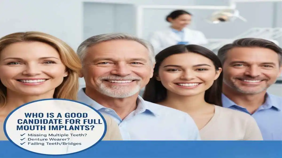 Who Is a Good Candidate for Full Mouth Implants